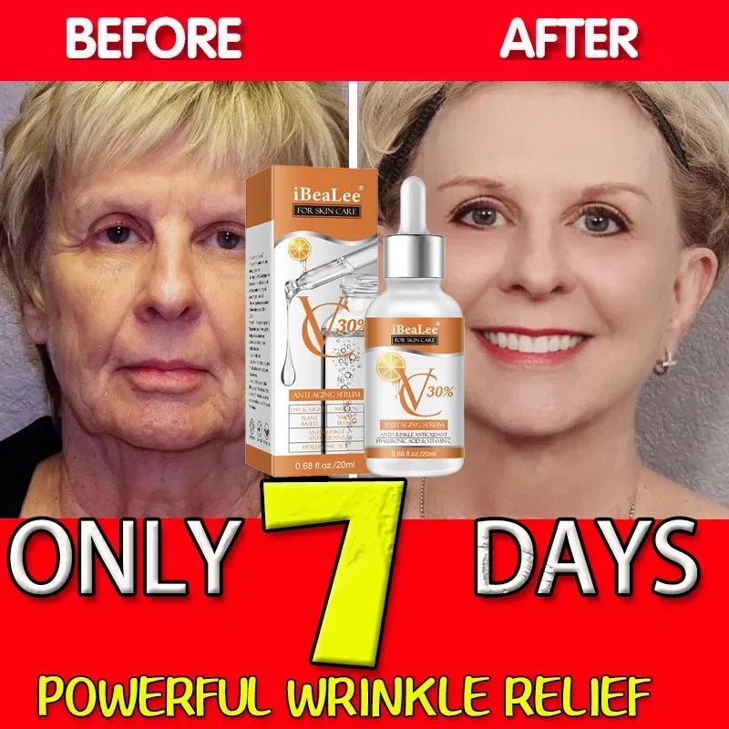 Premium 30% Vitamin C Serum For Face Anti Aging Wrinkle Facial Hyaluronic Acid Retinol Acids Boost Collagen Hydrate Skin Care - Reinvent Yourself