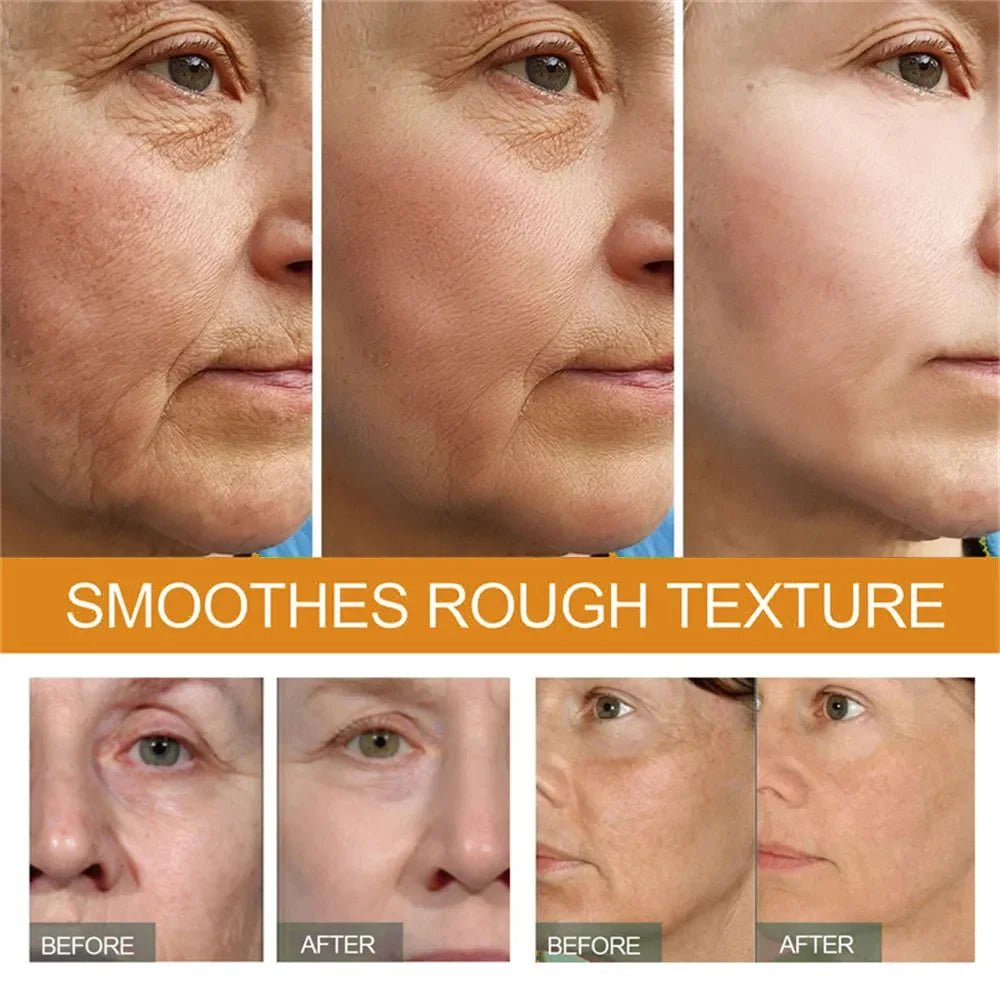 Premium 30% Vitamin C Serum For Face Anti Aging Wrinkle Facial Hyaluronic Acid Retinol Acids Boost Collagen Hydrate Skin Care - Reinvent Yourself