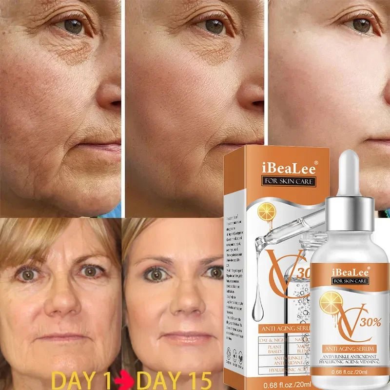 Premium 30% Vitamin C Serum For Face Anti Aging Wrinkle Facial Hyaluronic Acid Retinol Acids Boost Collagen Hydrate Skin Care - Reinvent Yourself